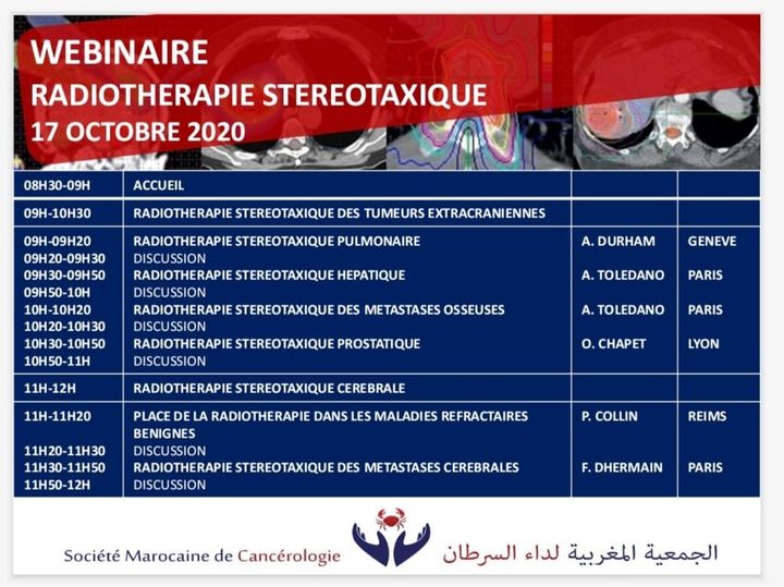 Radiothérapie Stéréotaxique