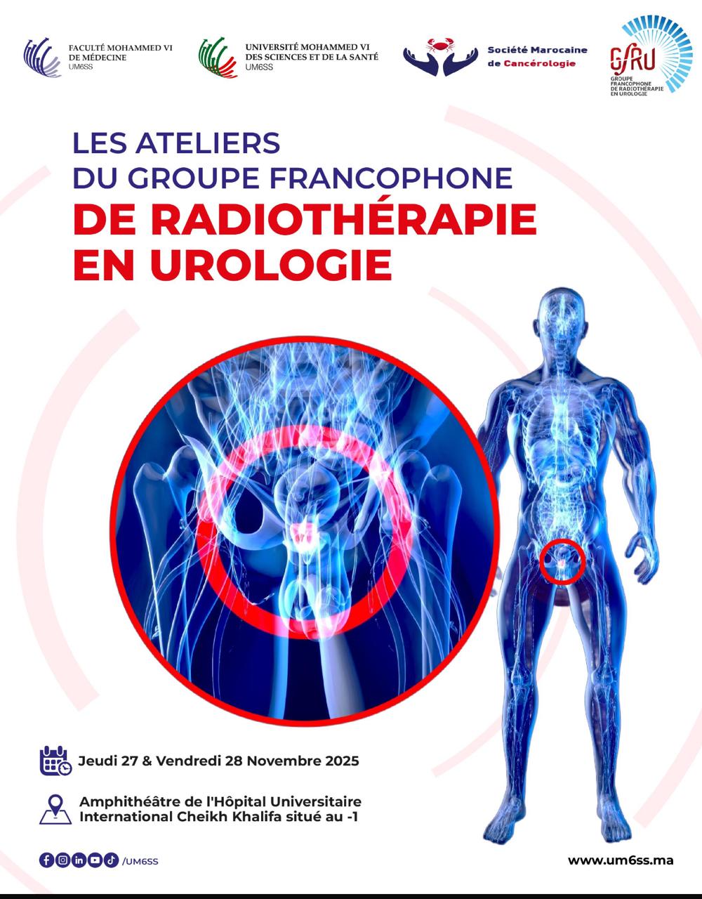 LES ATELIERS DU GROUPE FRANCOPHONE DE RADIOTHÉRAPIE EN UROLOGIE